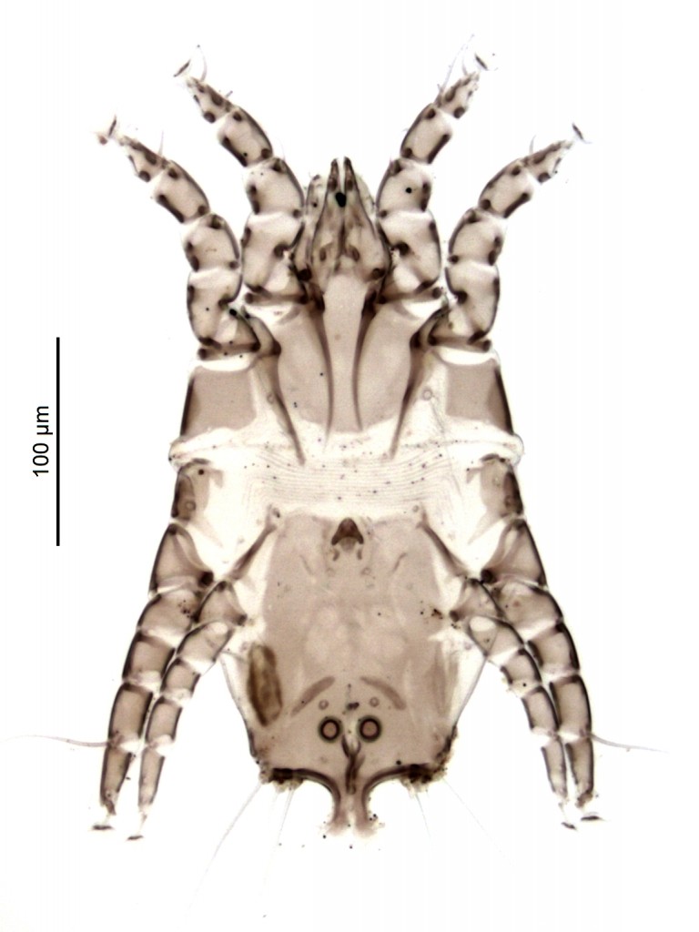01 Allopsoroptoides galli male ex Guira guira 01