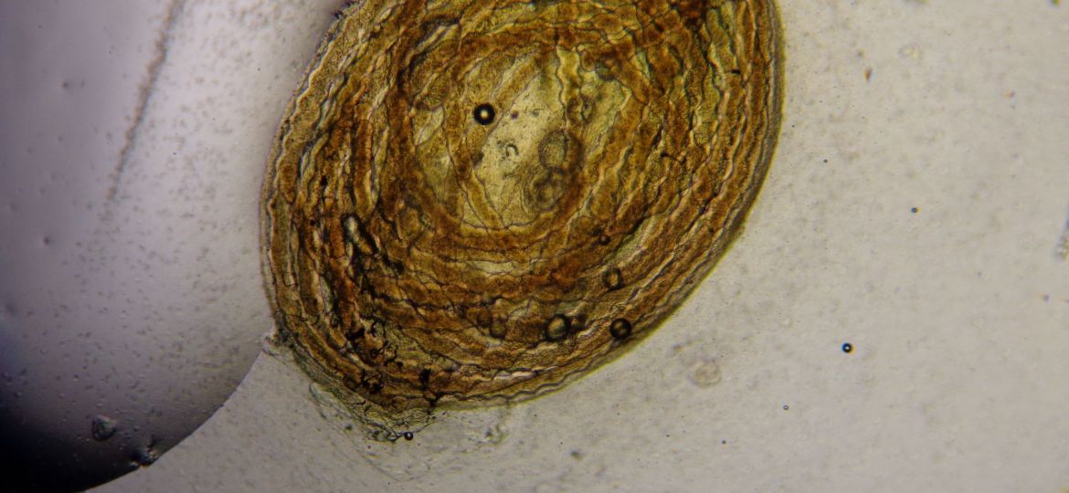 Pasmódio de Myxidium amazonense (filamentos) no interior da vesicula biliar de Corydoras melini.