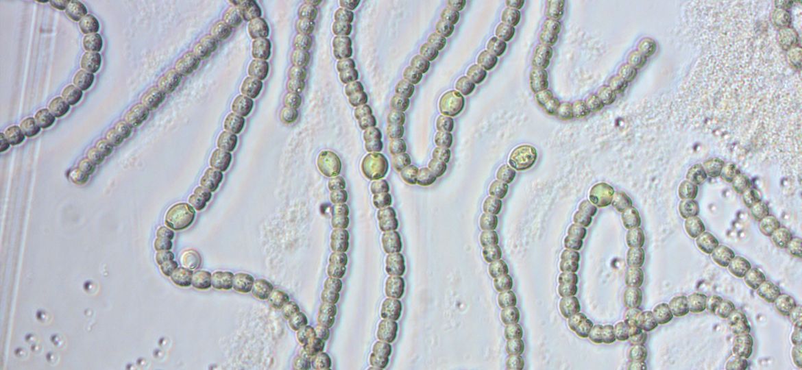Microscopia Nostoc 40x _baixa