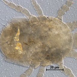 Dorso da espécie de ácaro Lasioseius biota. Foto: Ávyla Barros.